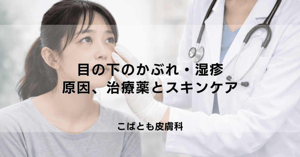 目の下のかぶれ・湿疹が治らない…原因と効果的な薬、スキンケア方法