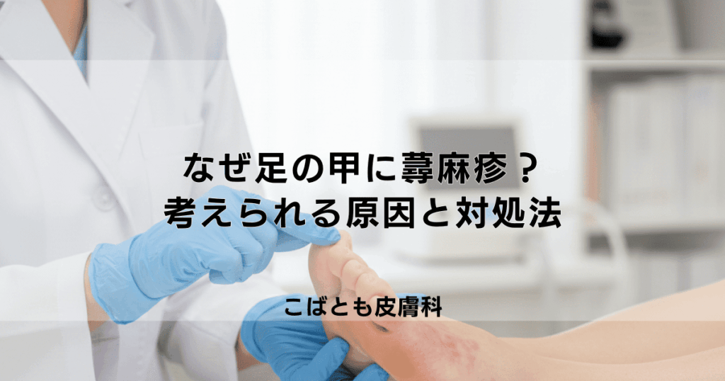 なぜ足の甲に蕁麻疹が？靴の圧迫やアレルギーなど考えられる原因と対処法