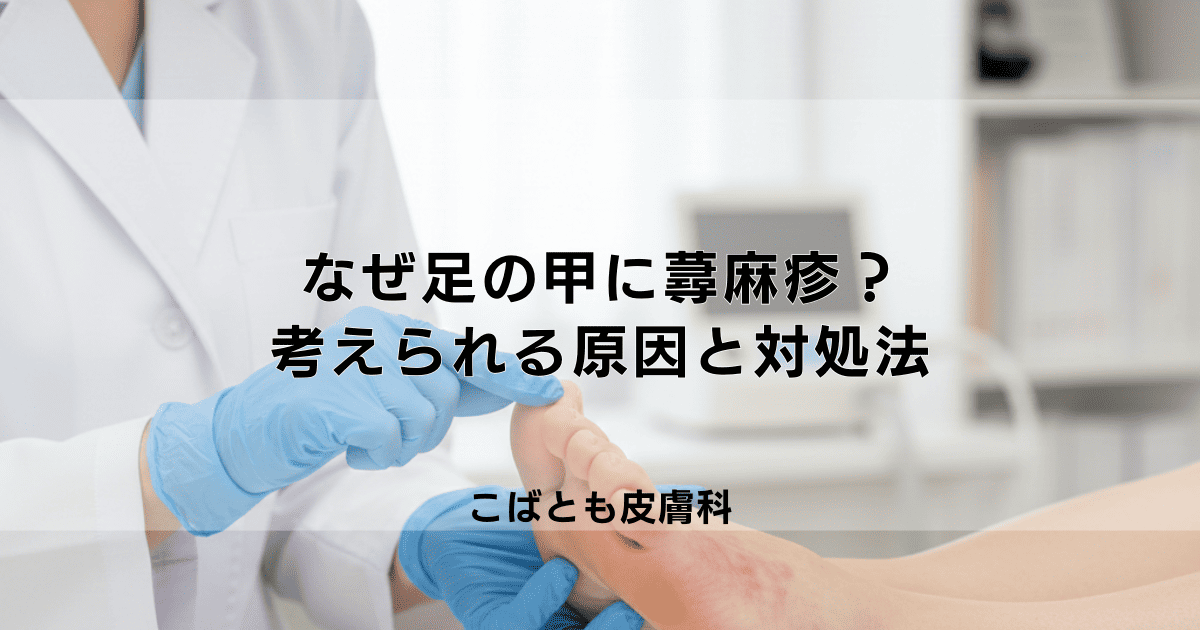 なぜ足の甲に蕁麻疹が？靴の圧迫やアレルギーなど考えられる原因と対処法