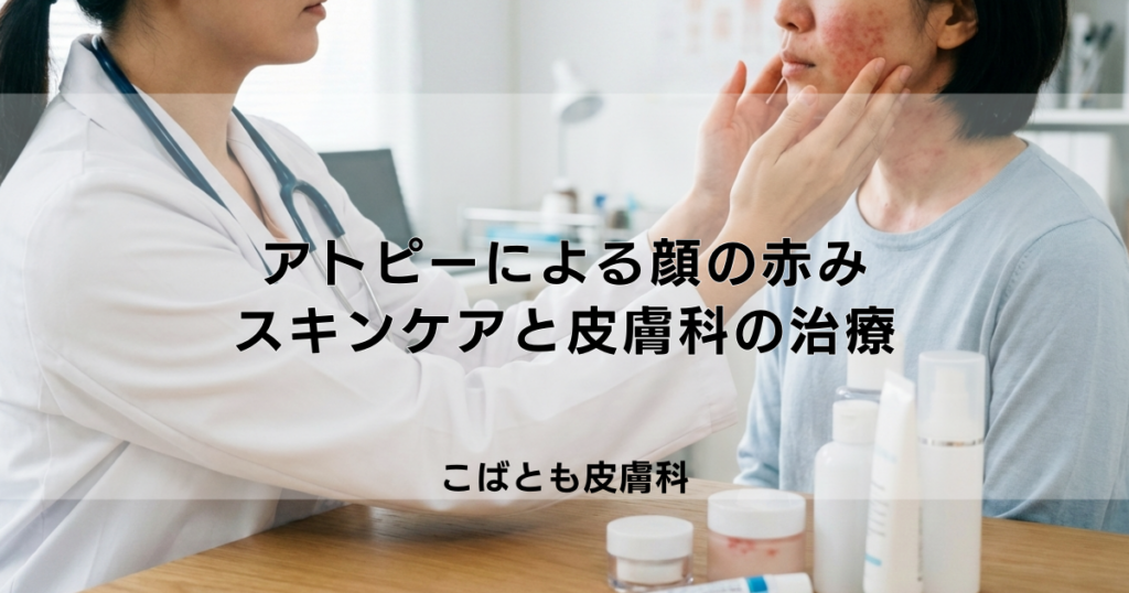 アトピーによる顔の赤みを消したい！スキンケアでの改善法と皮膚科の治療