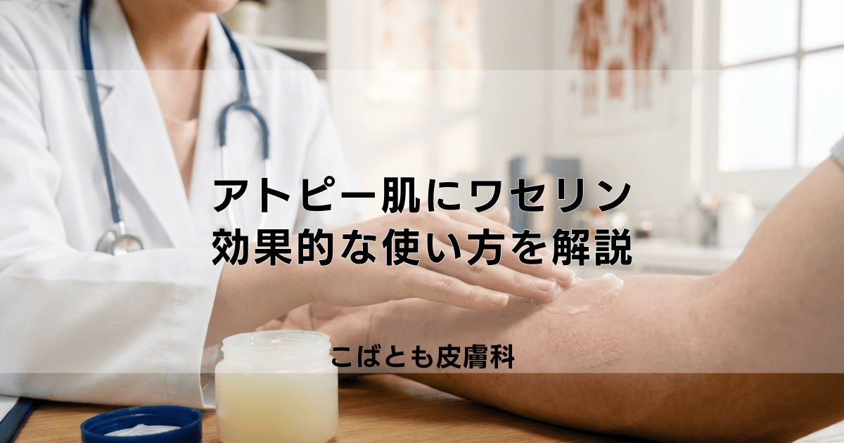 アトピーにワセリンは良くない?悪化する原因と効果的な使い方を解説