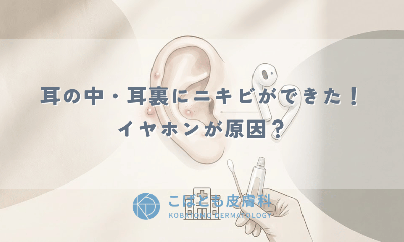 耳の中・耳裏にニキビができた！イヤホンが原因？痛い時の治し方と皮膚科へ行く目安