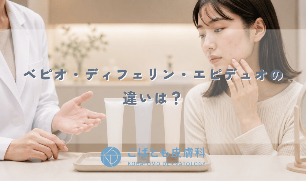 ベピオ・ディフェリン・エピデュオの違いは？皮膚科で処方されるニキビ塗り薬の使い分け