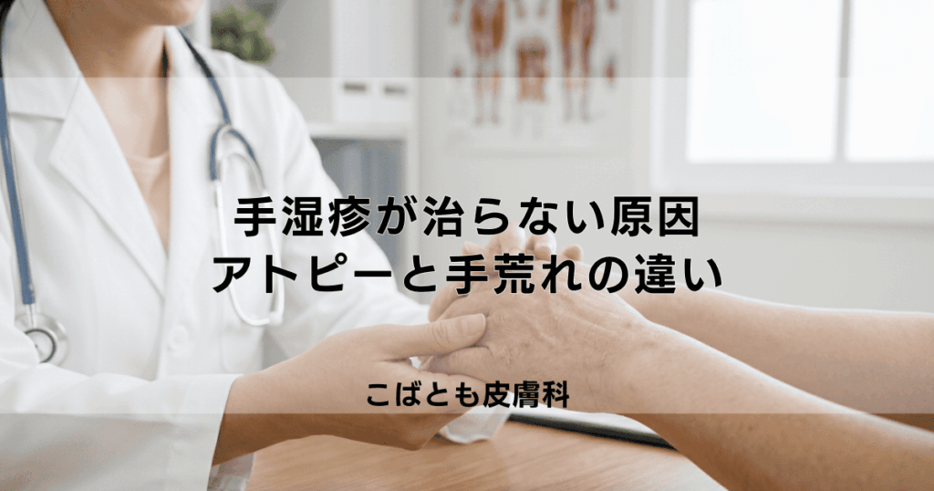 【手湿疹】治らない手のアトピーの原因は？手荒れとの違いと改善への道すじ