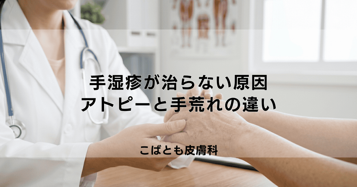 【手湿疹】治らない手のアトピーの原因は？手荒れとの違いと改善への道すじ