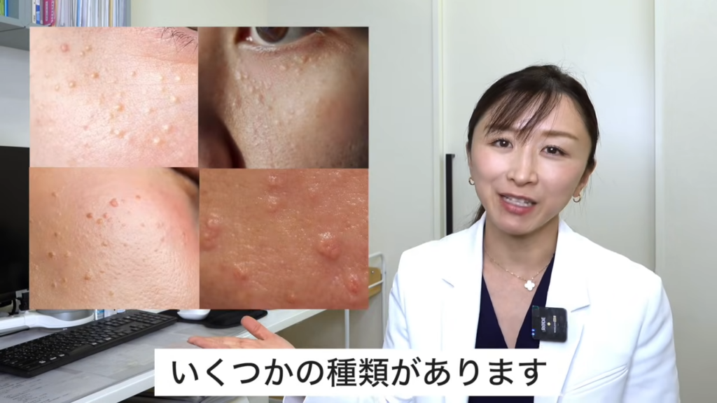 目の周りのブツブツには、いくつかの種類がある