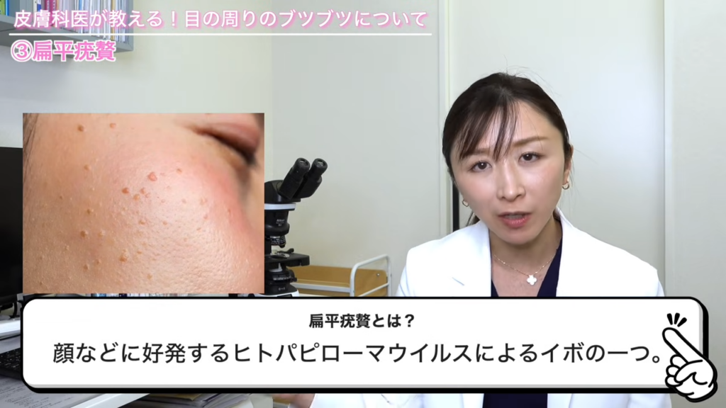 扁平疣贅の見た目