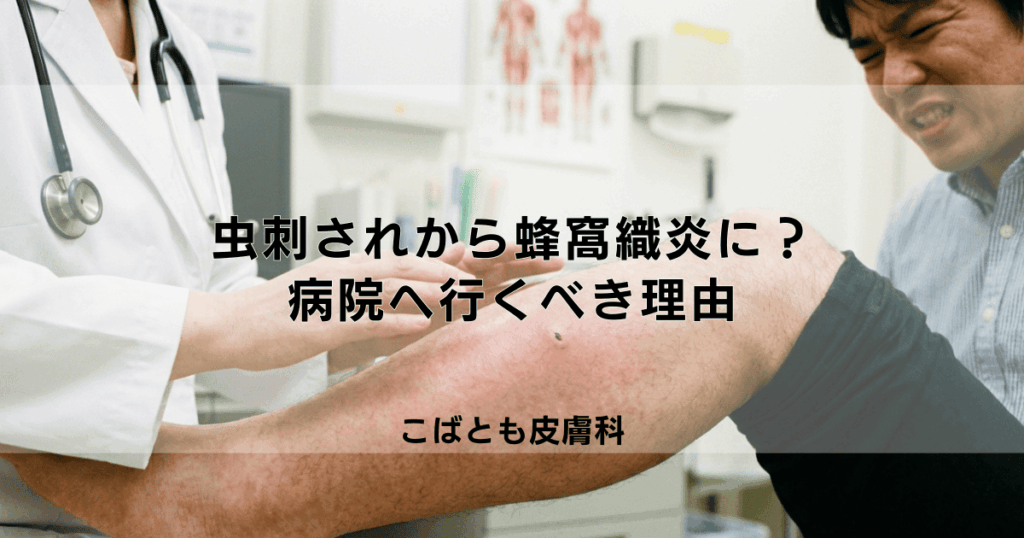 虫刺されから蜂窩織炎（ほうかしきえん）に？危険なサインとすぐに病院へ行くべき理由