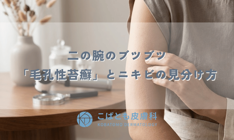 二の腕のブツブツはニキビじゃない?「毛孔性苔癬」との見分け方と皮膚科での治療