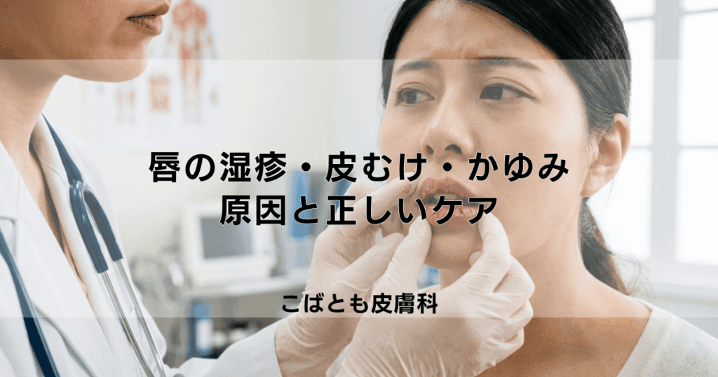 唇の湿疹・皮むけ・かゆみの治し方｜原因となるリップや食べ物と正しいケア