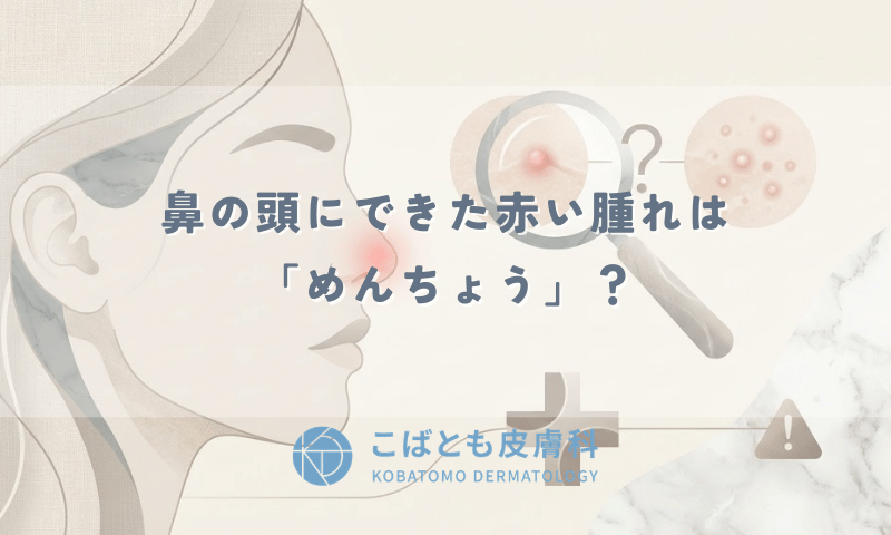鼻の頭にできた赤い腫れは「めんちょう」?ニキビとの違いと死亡リスクの噂について解説