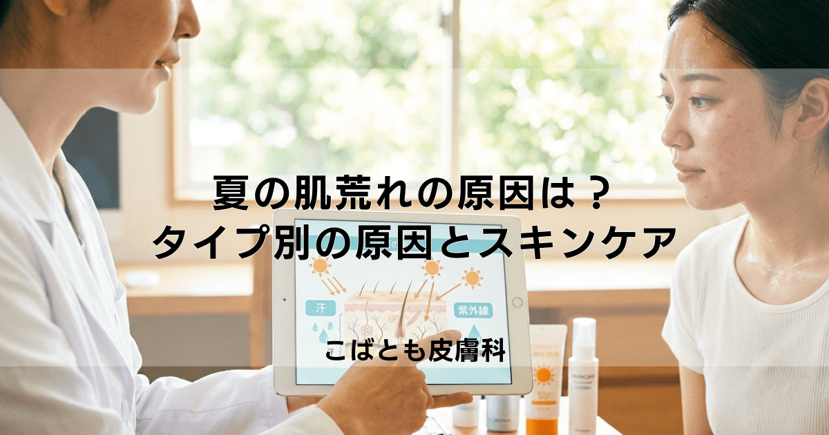夏の肌荒れ、原因は汗?紫外線?タイプ別の原因とスキンケア対策