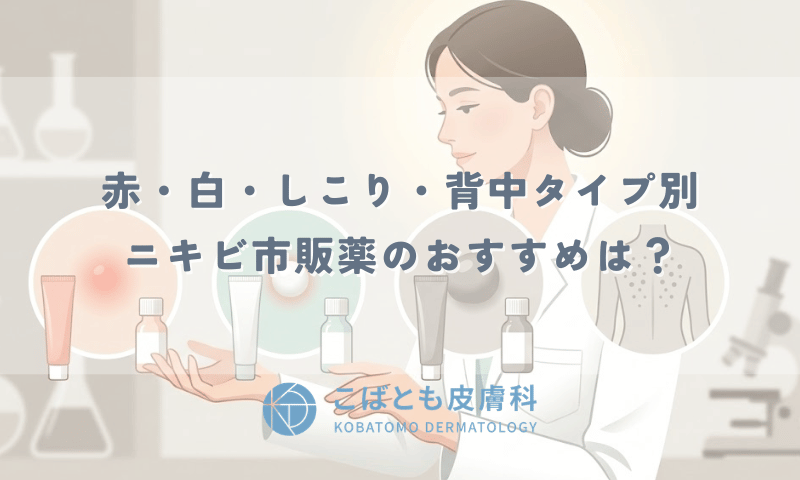 ニキビ市販薬のおすすめは?赤・白・しこり・背中タイプ別に皮膚科医が解説