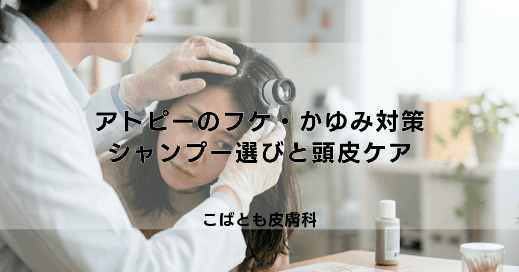 アトピーによる頭皮のフケ・かゆみ対策｜シャンプーの選び方と正しい頭皮ケア