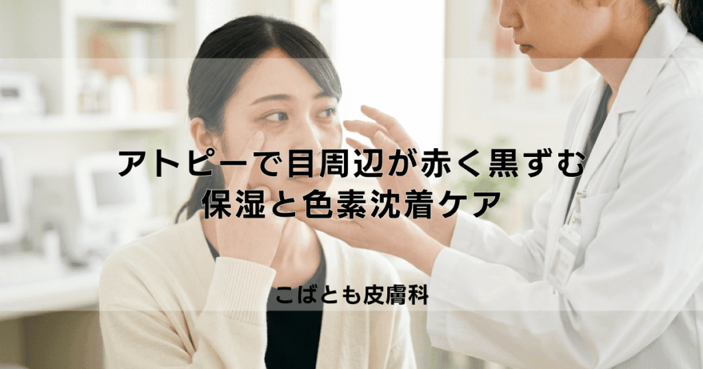 アトピーで目の周りが赤い・黒ずむ原因は？敏感な目元の保湿と色素沈着ケア