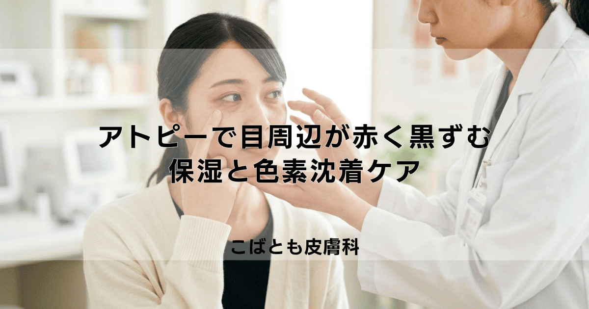 アトピーで目の周りが赤い・黒ずむ原因は？敏感な目元の保湿と色素沈着ケア