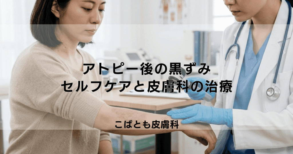 アトピー後の黒ずみ（色素沈着）は消える？セルフケアでの治し方と皮膚科の治療法