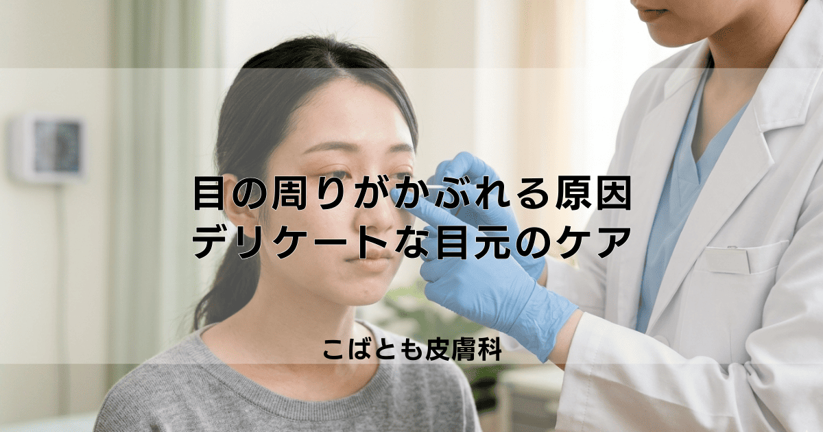 目の周りがかぶれる原因は？考えられる理由とデリケートな目元の正しいケア