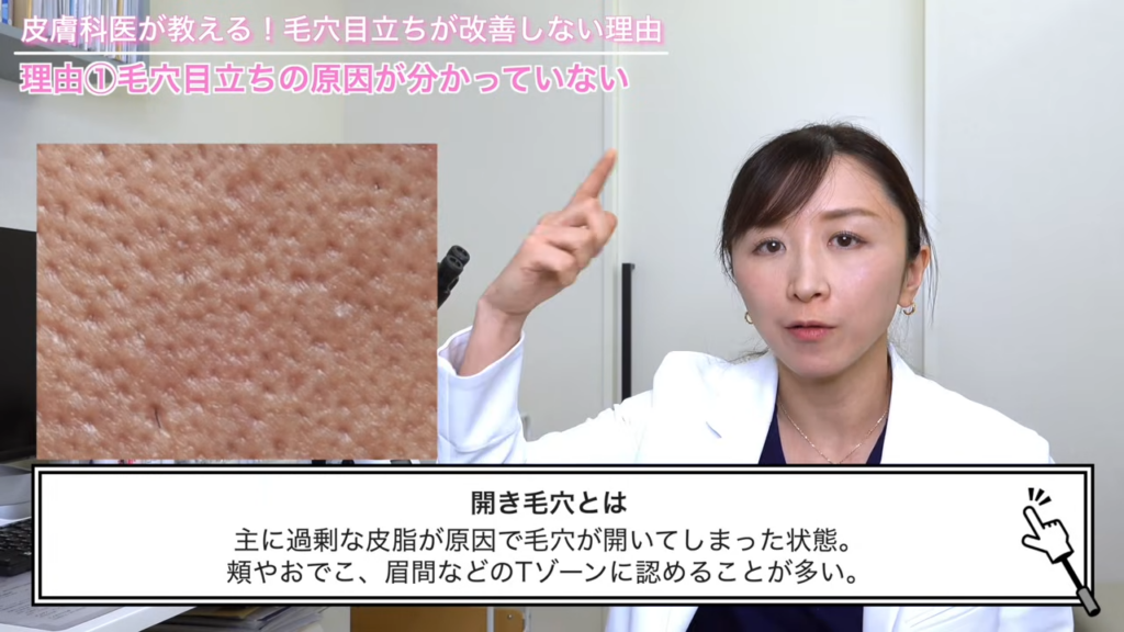 開き毛穴とは