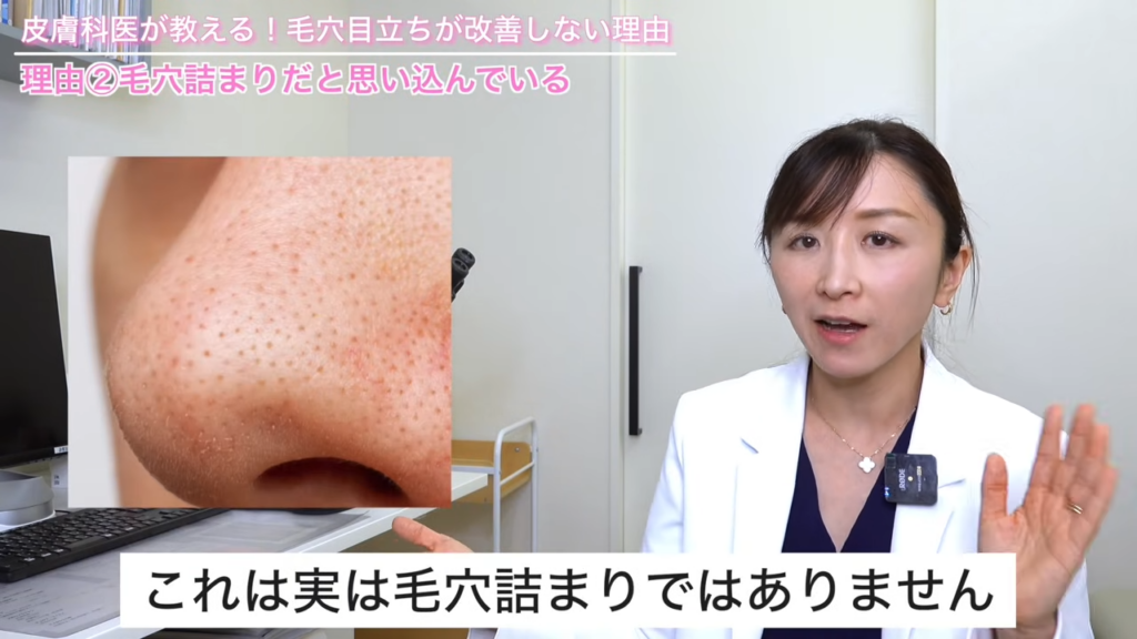 皮脂フィラメント