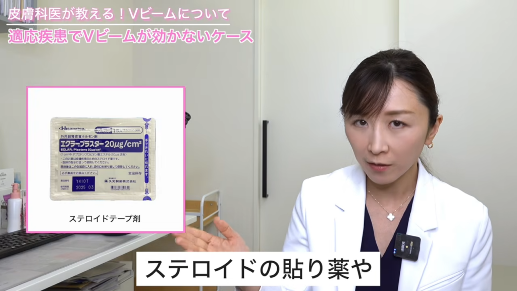 ステロイドの貼り薬