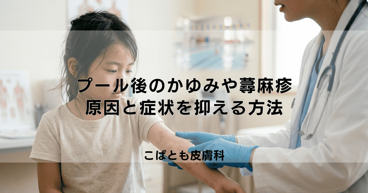 プール後のかゆみや蕁麻疹は塩素アレルギー？考えられる原因と症状を抑える方法