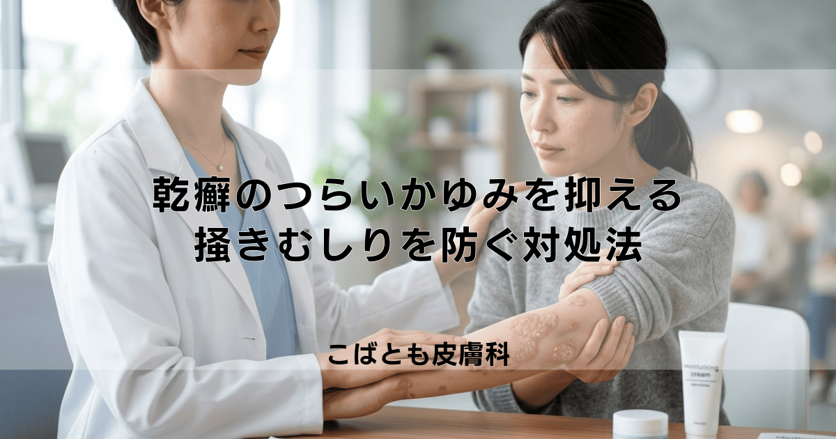乾癬のつらいかゆみを抑える方法｜掻きむしりを防ぐための効果的な対処法