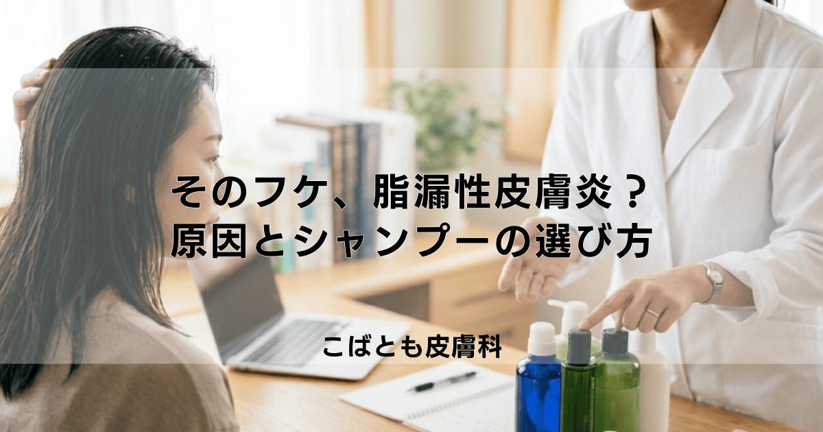 そのフケ、脂漏性皮膚炎かも?ベタつくフケの原因と正しいシャンプーの選び方