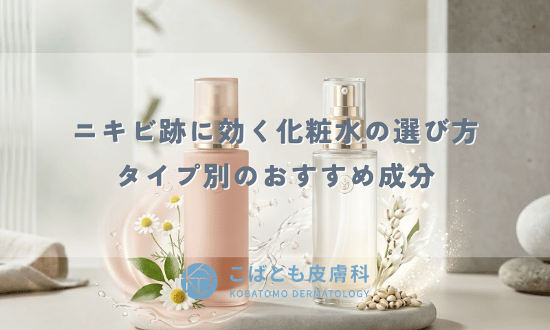 ニキビ跡に効く化粧水の選び方｜赤み・色素沈着タイプ別のおすすめ成分