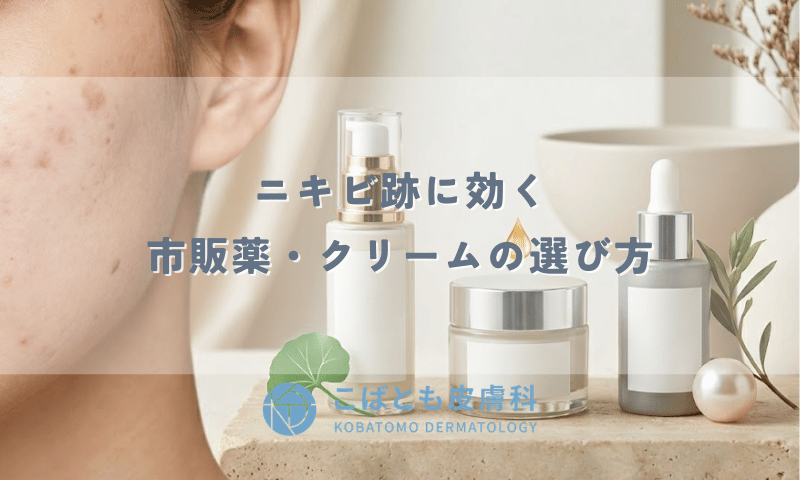 ニキビ跡に効く市販薬・クリームの選び方｜赤み・シミ・クレータータイプ別おすすめ成分