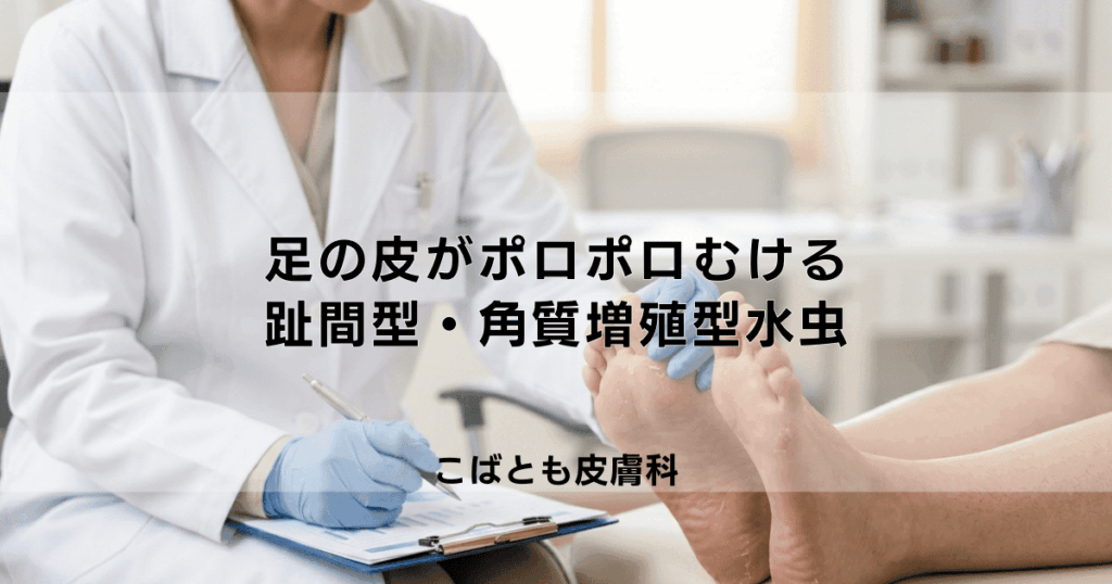 足の皮がポロポロむける…それ水虫かも？趾間型・角質増殖型水虫の治し方