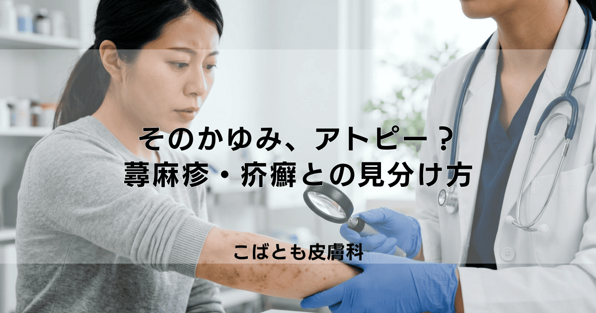 そのかゆみ、アトピー？蕁麻疹・疥癬（かいせん）との見分け方と対処法の違い