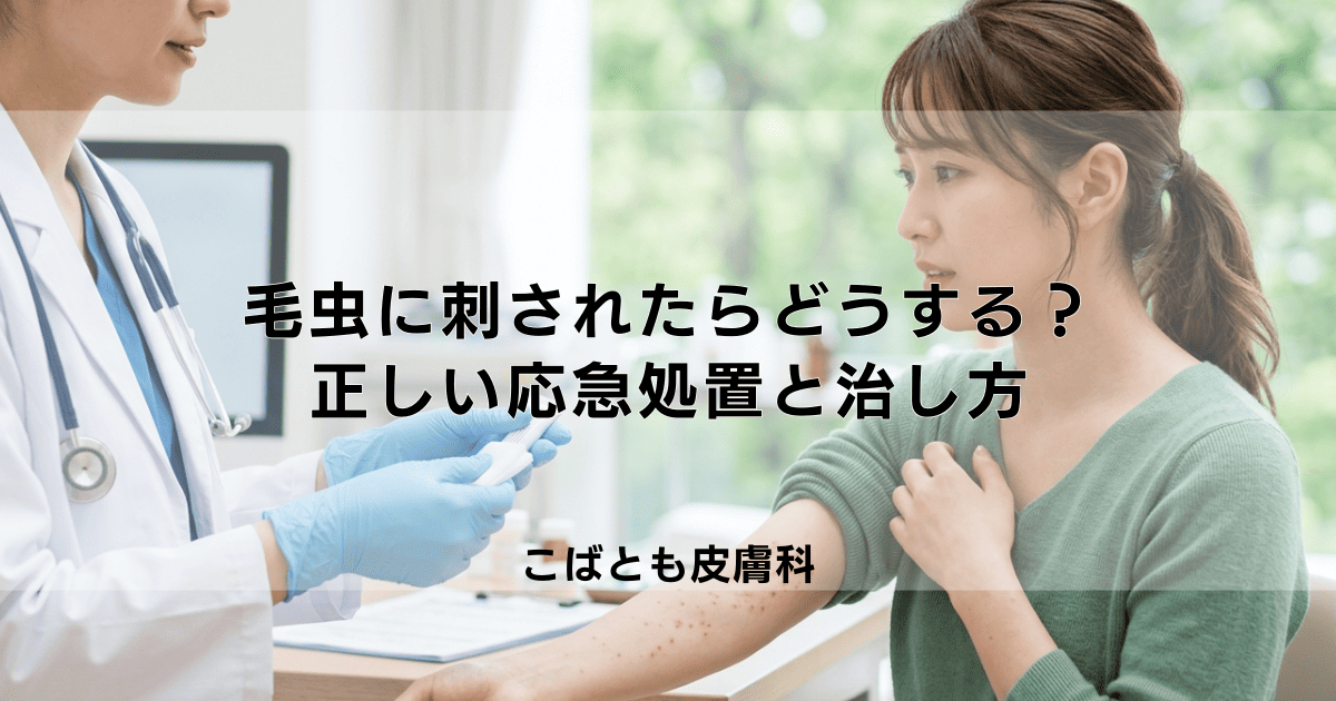 毛虫に刺されたらどうする？湿疹・蕁麻疹が出た時の正しい応急処置と治し方