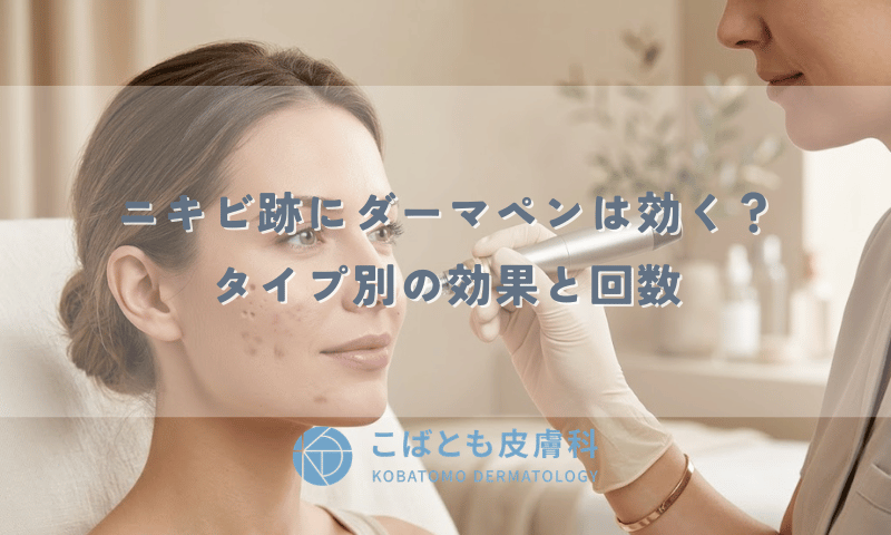 ニキビ跡にダーマペンは効く？クレーター・赤み・色素沈着タイプ別の効果と回数