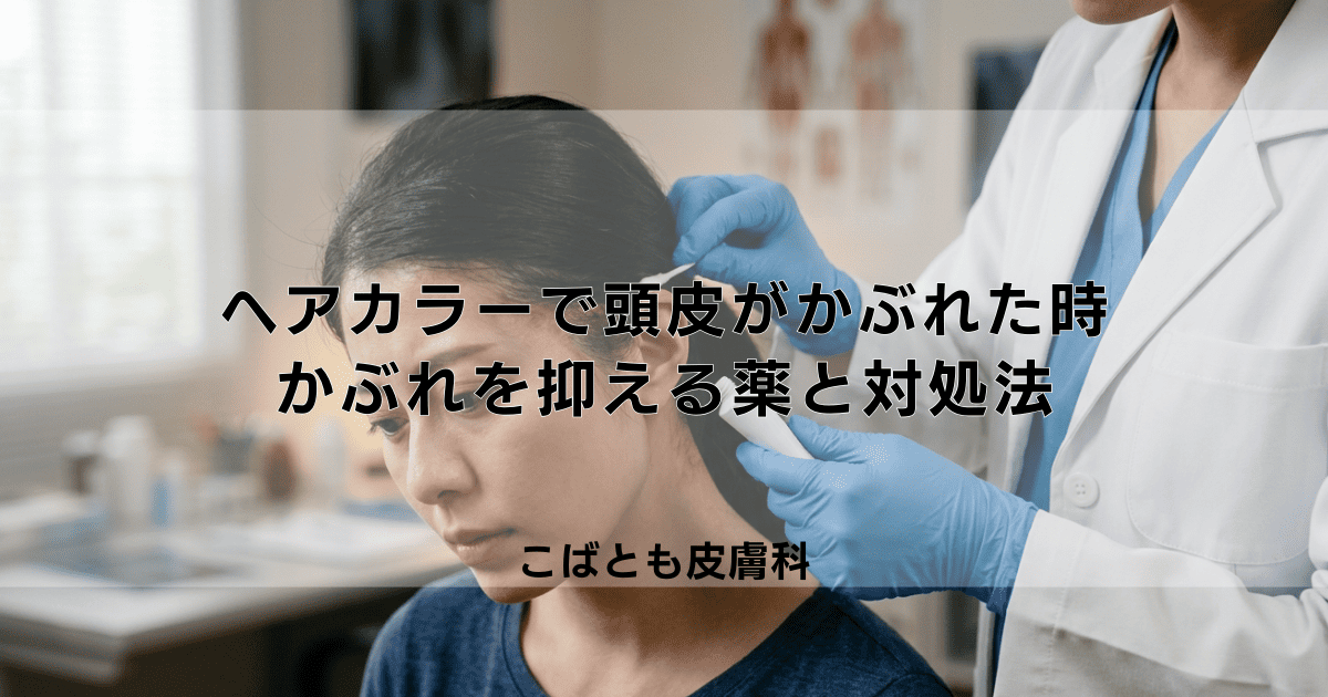 ヘアカラーで頭皮がかぶれた時の治療法｜かゆみと赤みを抑える薬と対処法