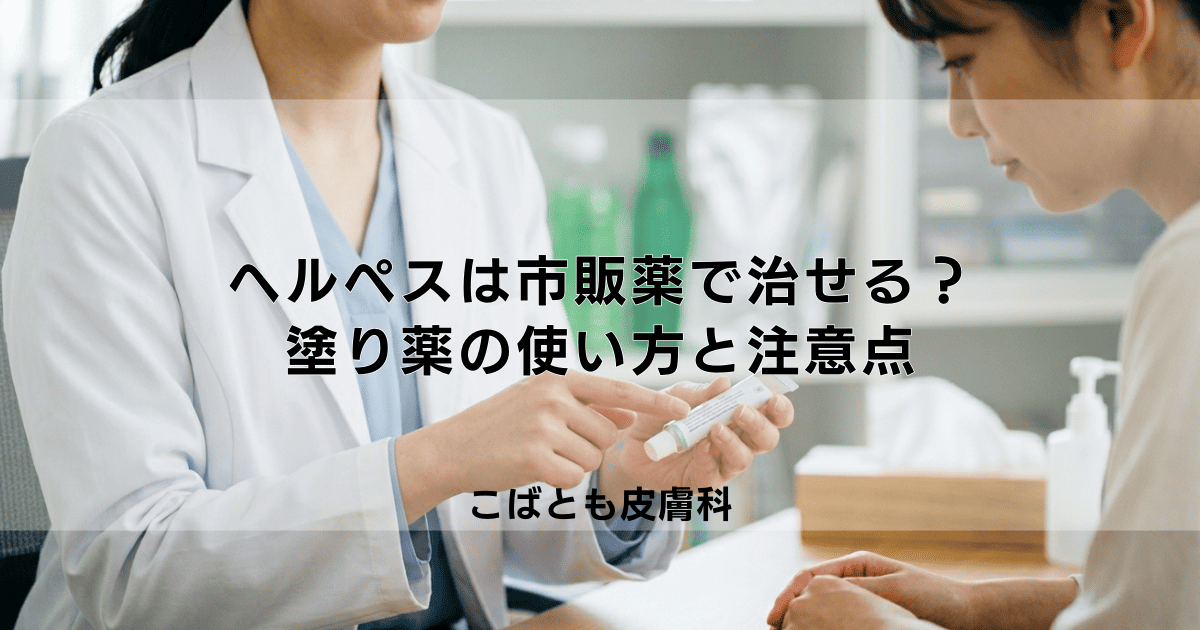 ヘルペスは市販薬で治せる？再発用の塗り薬の正しい使い方と注意点