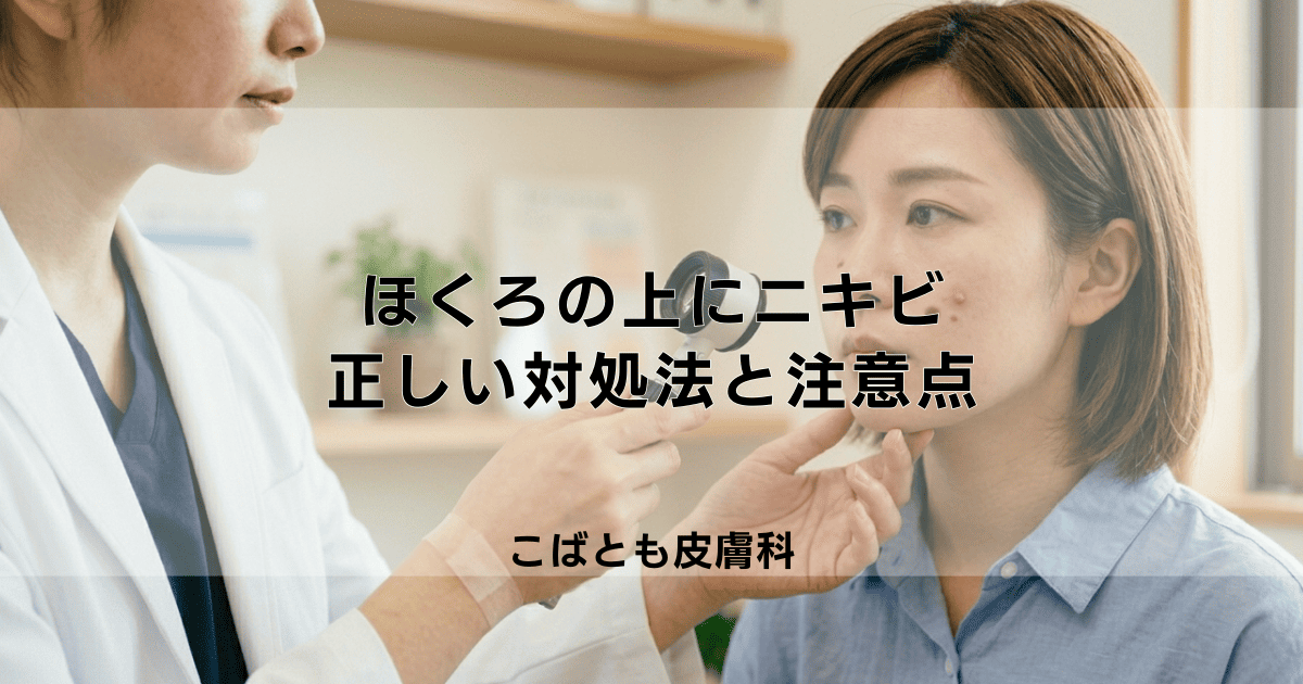 ほくろの上にニキビができた！潰しても大丈夫？正しい対処法と注意点