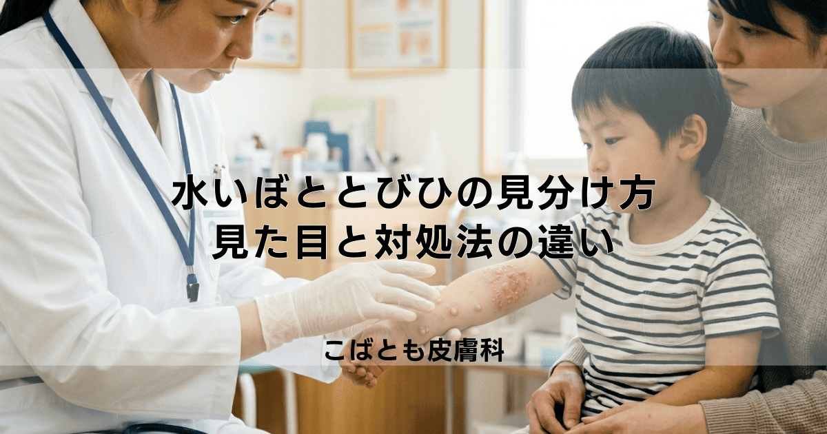 「水いぼ」と「とびひ」の見分け方｜症状の見た目と対処法の違い