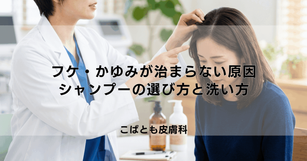 フケ・かゆみが治まらない原因とは？症状を改善するシャンプーの選び方と洗い方