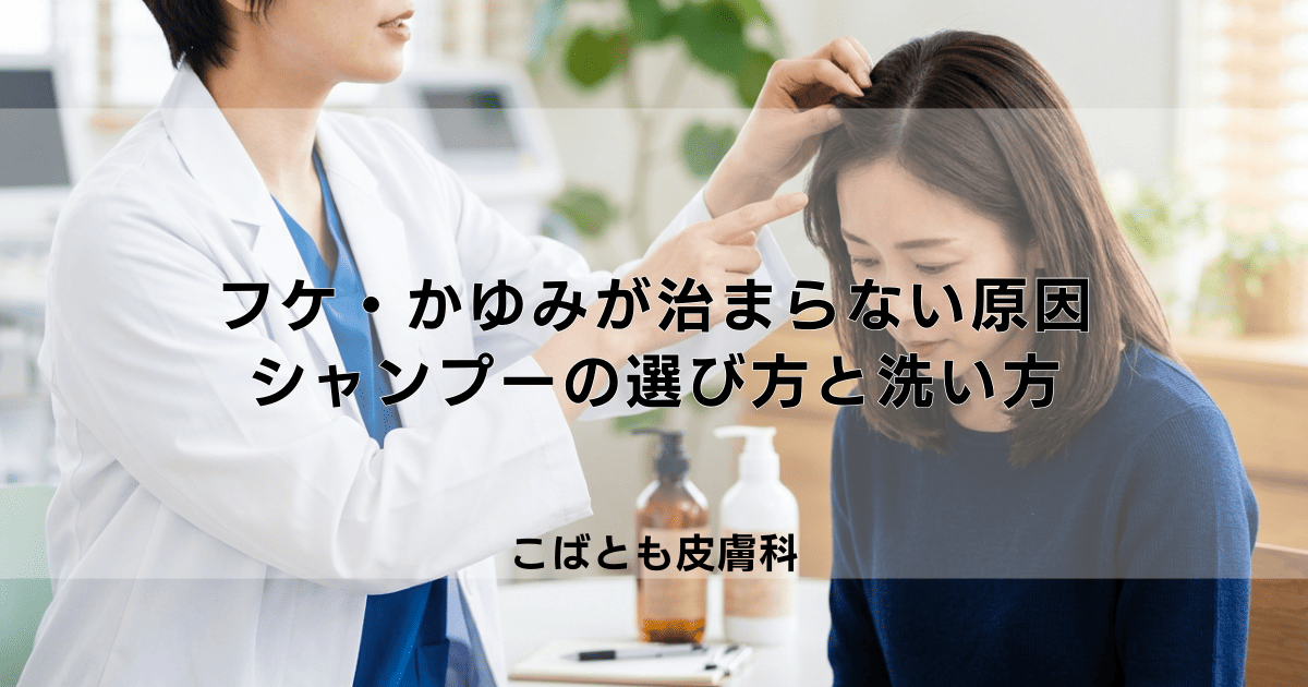 フケ・かゆみが治まらない原因とは？症状を改善するシャンプーの選び方と洗い方