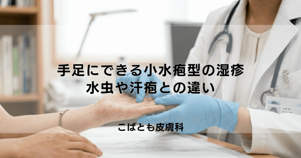 手足にできる「小水疱型」の湿疹とは？水虫や汗疱（かんぽう）との違い