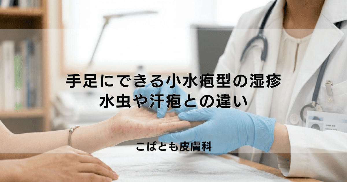 手足にできる「小水疱型」の湿疹とは？水虫や汗疱（かんぽう）との違い