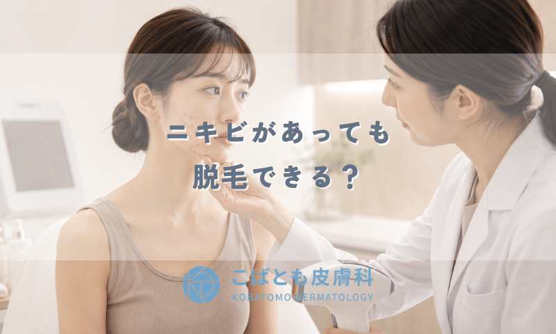 ニキビがあっても脱毛できる?脱毛後にニキビが増える原因とNGなケースを解説
