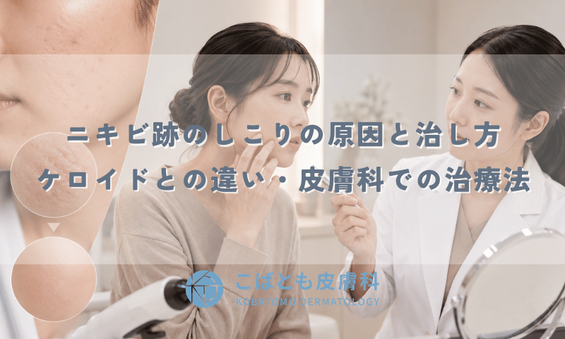 ニキビ跡のしこりの原因と治し方|ケロイドとの違いは?皮膚科での治療法を解説