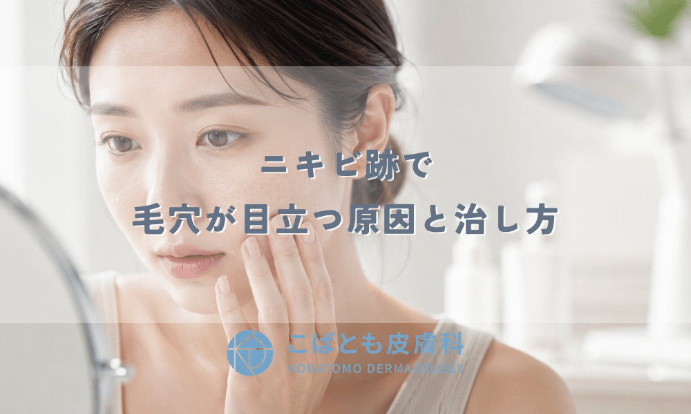 ニキビ跡で毛穴が目立つ原因と治し方｜開き毛穴を改善するスキンケアと皮膚科治療