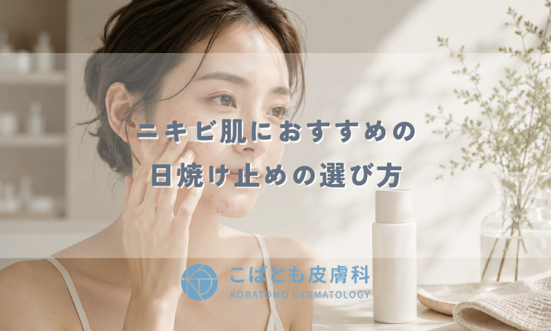 ニキビ肌におすすめの日焼け止めの選び方｜紫外線で悪化する理由と塗り方のコツ