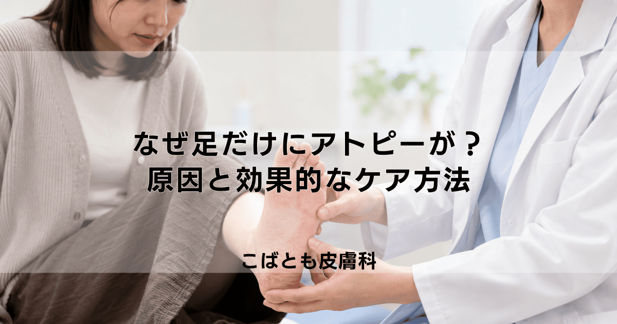 なぜ足だけにアトピーが？足の裏・足指の湿疹の原因と効果的なケア方法