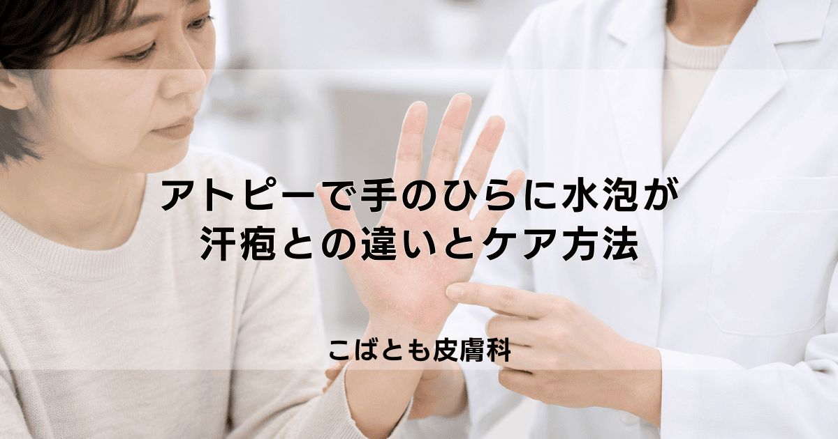 アトピーで手のひらに水泡が…これって何?汗疱との違いと正しいケア方法