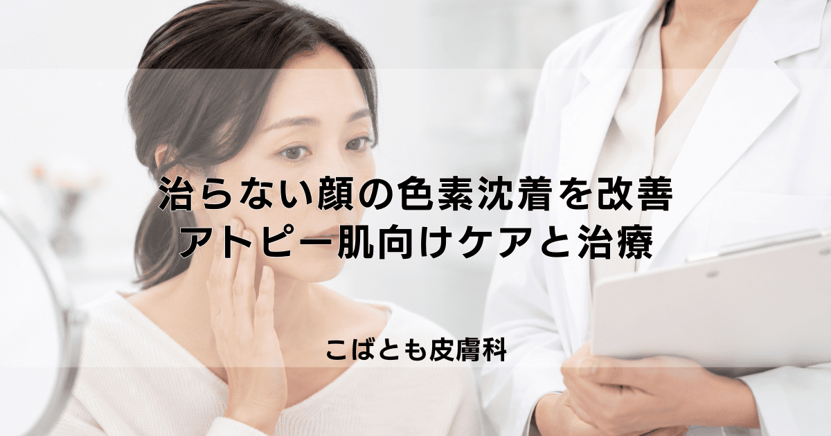 治らない顔の色素沈着を改善する方法｜アトピー肌向けセルフケアと皮膚科治療