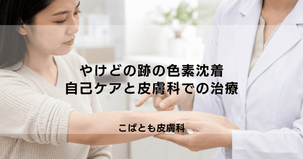 やけどの跡の色素沈着を薄くする方法｜自分でできるケアと皮膚科での治療法